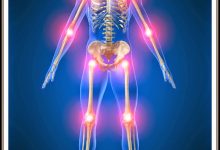 Photo of أسباب آلام العظام والعضلات | 8 أسباب معروفة لآلام العظام