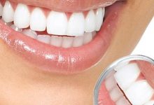 Photo of فوائد الملح للاسنان| 5 وصفات لأسنان أكثر بياضاً كنجوم هوليود