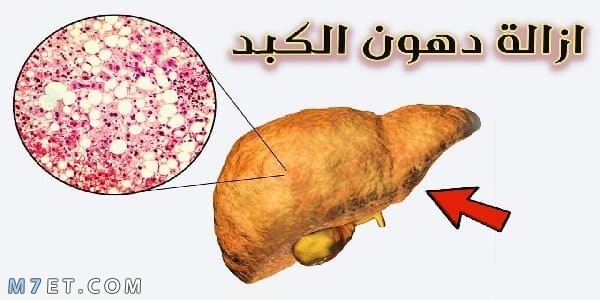 دواء دهون الكبد