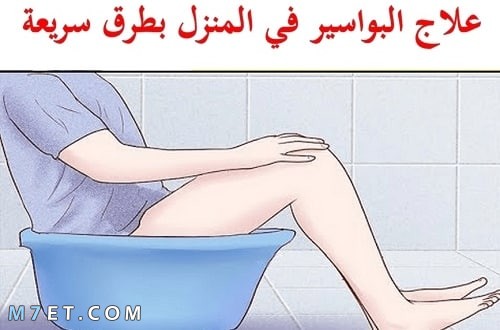 كيفية علاج البواسير في المنزل