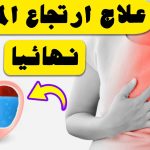 علاج ارتجاع المرئ