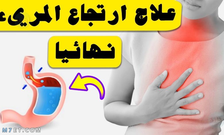 علاج ارتجاع المرئ