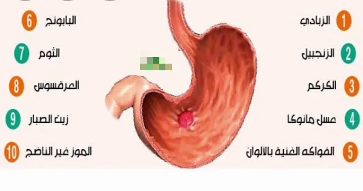 أطعمة تساعد على علاج التهاب المعدة