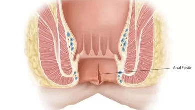 Photo of أفضل مرهم لعلاج البواسير والشرخ الشرجي
