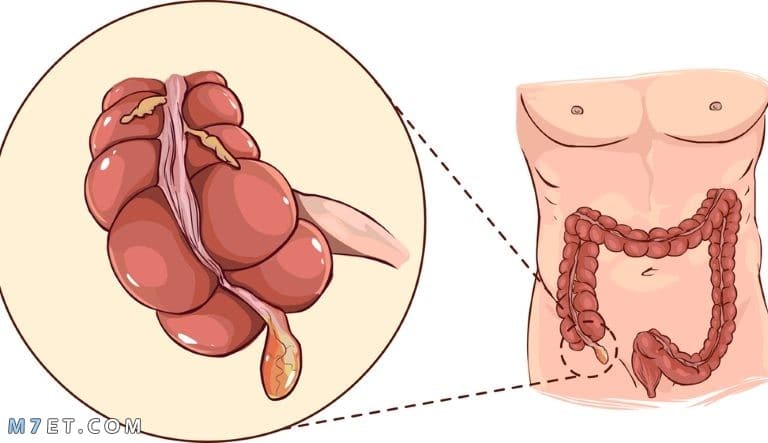 اين توجد الزايده