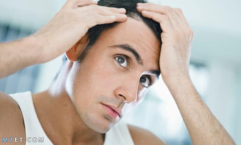 أشهر hair regain لعلاج الصلع وتساقط الشعر