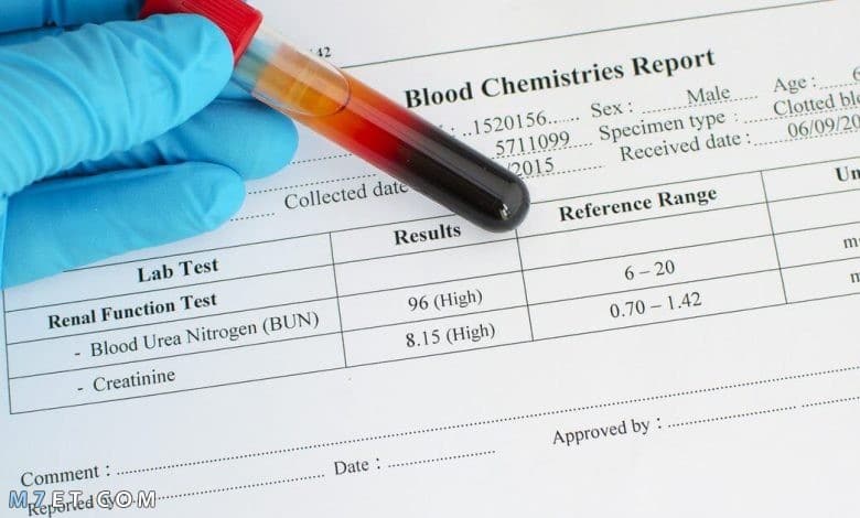 تحليل creatinine 