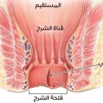 أفضل مرهم لعلاج الشرخ